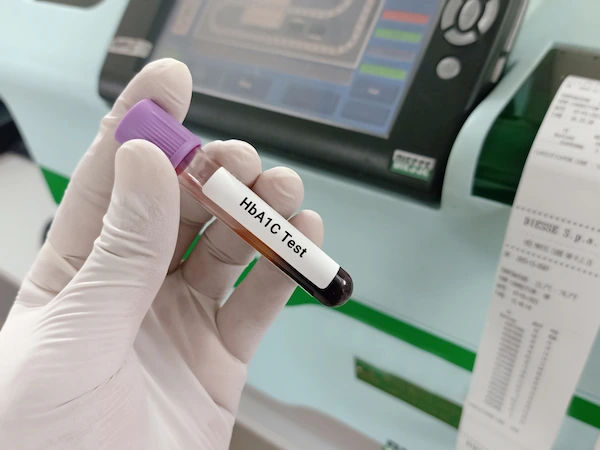 hba1c test